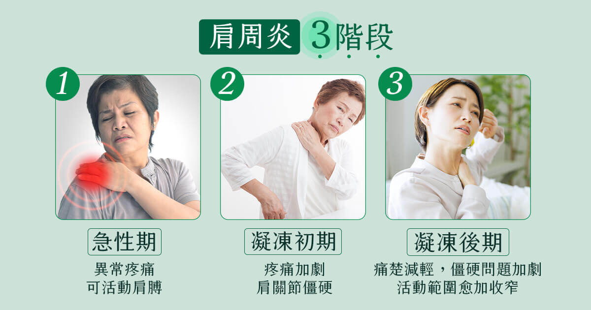 肩周炎(五十肩)3階段症狀