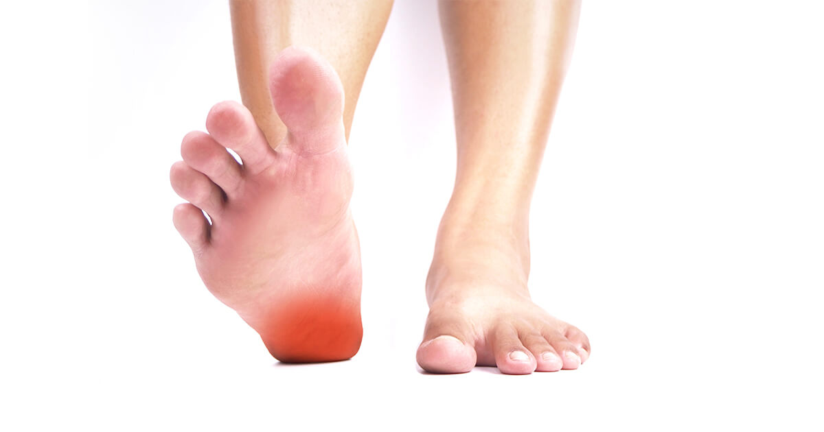 踏地腳板底感刺痛-足底筋膜炎症狀