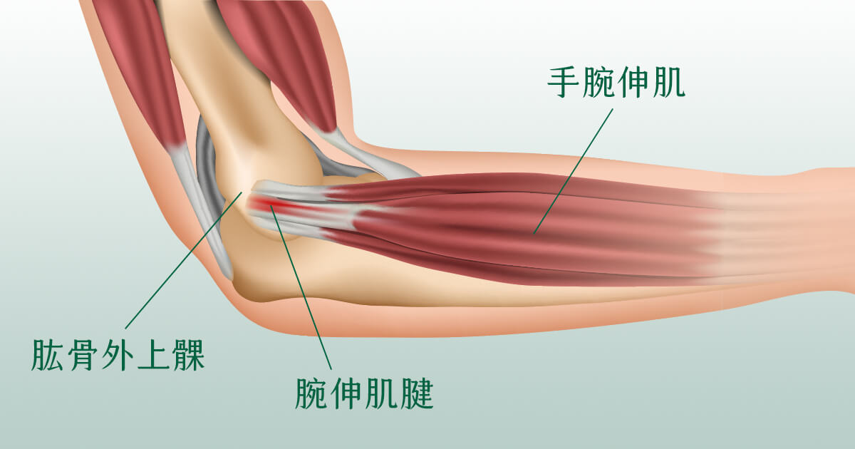從手肘、手臂結構看網球手