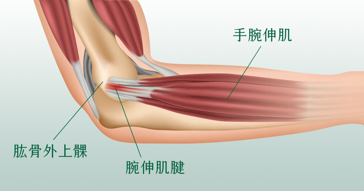 手肘、手臂結構解剖圖看網球手